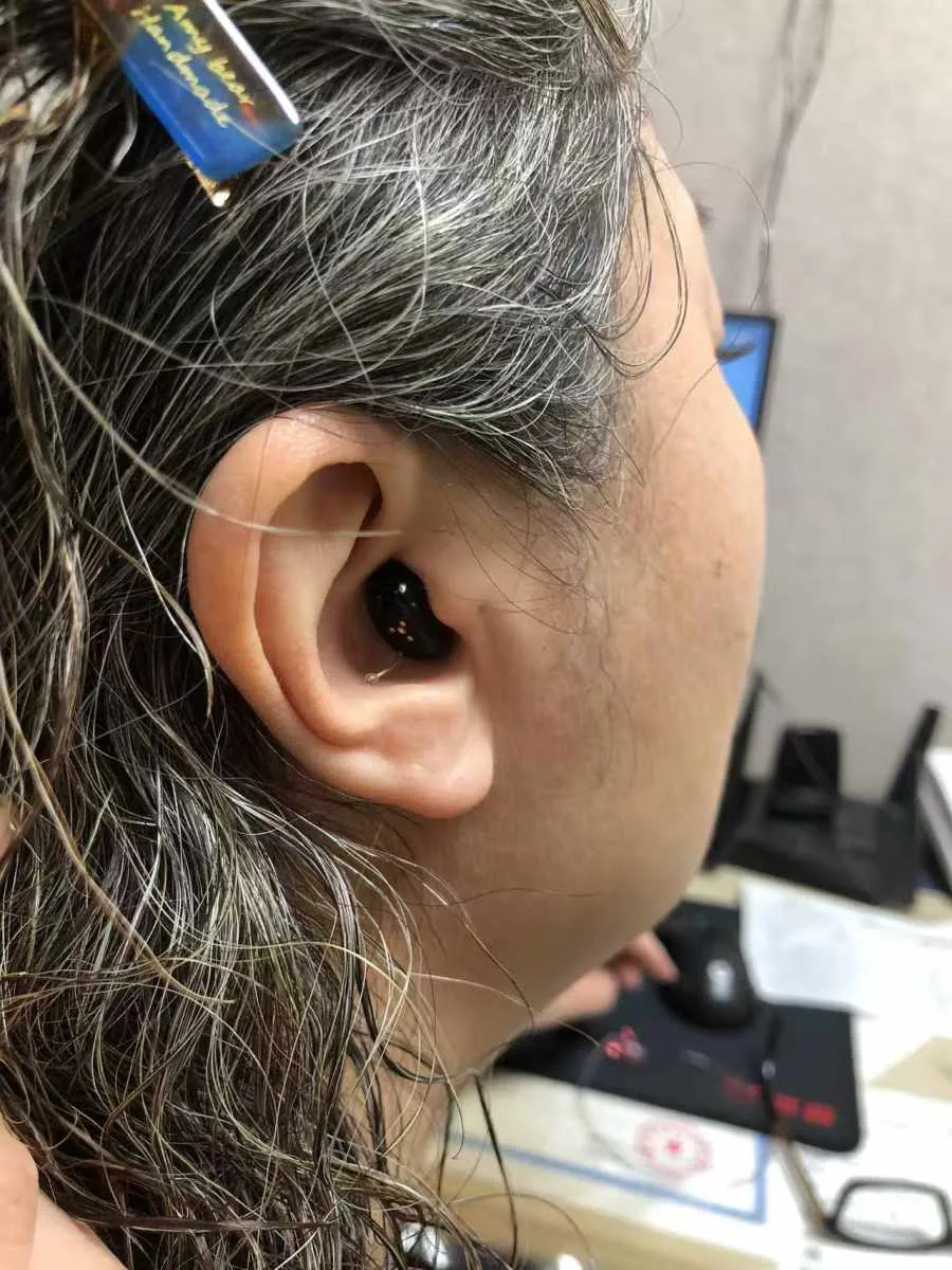 新品上市：斯达克-珈音系列【沈阳中街帅府助听器】